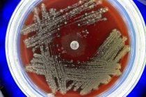 Placa de Petri con colonias de microbios, primer plano . - foto de stock