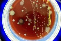 Petri dish with colonies of microbes, close-up. — Stock Photo