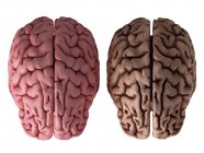 Illustration en 3D d'un cerveau sain et malsain sur fond blanc . — Photo de stock