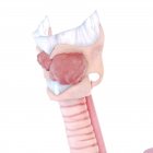 Illustrazione resa 3d del cancro della laringe su sfondo bianco . — Foto stock
