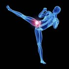 3D надані ілюстрація чоловічого здоровий спортсмен хворобливі кульшового суглоба. — стокове фото