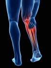 3D gerenderte Illustration der blauen Silhouette männlicher Beine mit schmerzhaftem Kalb auf schwarzem Hintergrund. — Stockfoto