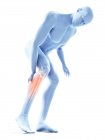3d rendered illustration of blue silhouette of man with painful calf. — Stock Photo