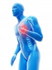 3D gerenderte Illustration der blauen Silhouette eines Mannes mit Brustschmerzen. — Stockfoto