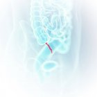 Medical illustration of visible appendix in human body. — Stock Photo