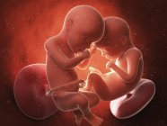 Medizinische Illustration von Zwillingen im Mutterleib. — Stockfoto