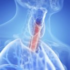 Medical illustration of inflamed trachea in human body. — Stock Photo