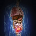 Illustration du cancer du côlon dans la silhouette du corps humain . — Photo de stock
