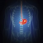 Illustrazione del cancro allo stomaco nella silhouette del corpo umano . — Foto stock