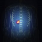 Darstellung von Gallenblasenkrebs in der Silhouette des menschlichen Körpers. — Stockfoto