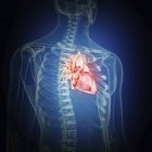 Illustration of inflamed heart in human body silhouette. — Stock Photo