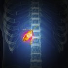 Ілюстрація раку жовчного міхура в силуеті людського тіла . — стокове фото