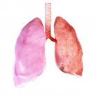 Ілюстрація здорової та ураженої легенів і плеври. — стокове фото