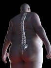 Illustration of silhouette of obese man with visible spine. — Stock Photo