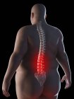 Illustration der Silhouette eines fettleibigen Mannes mit Rückenschmerzen. — Stockfoto
