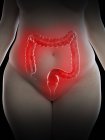 Ilustración de mujer con sobrepeso con colon inflamado sobre fondo negro
. - foto de stock