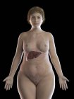 Ilustración de mujer con sobrepeso con hígado visible sobre fondo negro
. - foto de stock