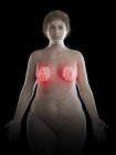 Ilustração de mulher com sobrepeso com glândulas mamárias inflamadas em fundo preto . — Fotografia de Stock