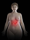 Ilustración de la mujer con sobrepeso con el estómago doloroso visible sobre fondo negro
. — Stock Photo