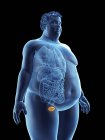 Illustration of silhouette of obese man with visible bladder. — Stock Photo