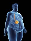 Illustration of silhouette of obese man with visible stomach. — Stock Photo