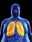 Ilustração da silhueta do homem obeso com pulmões visíveis . — Fotografia de Stock