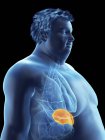 Illustration of silhouette of obese man with visible spleen. — Stock Photo