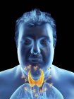 Illustrazione della malattia tiroidea autoimmune nel corpo maschile obeso . — Foto stock