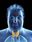 Иллюстрация силуэта толстяка с видимой щитовидной железой . — стоковое фото