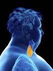 Illustration of silhouette of obese man with visible thyroid gland. — Stock Photo