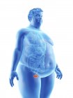 Illustration of silhouette of obese man with visible bladder. — Stock Photo