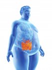 Ilustração da silhueta do homem obeso com intestino visível
. — Fotografia de Stock