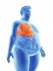 Illustration of silhouette of obese man with visible lungs. — Stock Photo