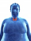 Illustration de la silhouette d'un homme obèse avec glande thyroïde visible . — Photo de stock