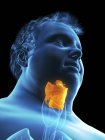 Illustration de la silhouette d'un homme obèse au larynx visible . — Photo de stock