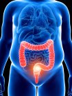 Illustration of silhouette of obese man with painful colon. — Stock Photo
