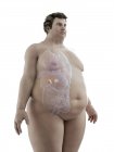 Illustration de la figure de l'homme obèse avec des glandes surrénales visibles . — Photo de stock