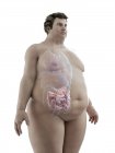 Illustration of figure of obese man with visible intestine. — Stock Photo