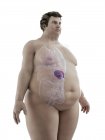 Ілюстрація фігури ожиріння людини з видимою селезінкою . — стокове фото
