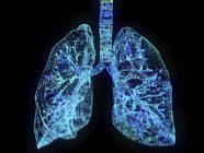 Abbildung abstrakter Plexus-Lungen auf schwarzem Hintergrund. — Stockfoto