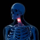 Ilustração digital do pescoço doloroso no esqueleto humano . — Fotografia de Stock