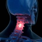 Digital illustration of painful neck in human skeleton. — Stock Photo