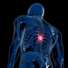 Цифровая иллюстрация болезненного грудного отдела позвоночника в скелете человека
. — стоковое фото