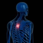 Цифровая иллюстрация болезненного грудного отдела позвоночника в скелете человека . — стоковое фото