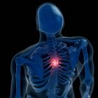 Цифровая иллюстрация болезненного грудного отдела позвоночника в скелете человека
. — стоковое фото