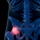 Illustration numérique de l'articulation douloureuse de la hanche dans le squelette humain . — Photo de stock