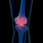 Digital illustration of painful knee in human skeleton. — Stock Photo