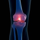 Ilustração digital do joelho doloroso no esqueleto humano . — Fotografia de Stock