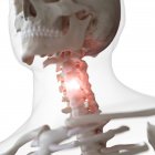 Digital illustration of painful cervical spine in human skeleton. — Stock Photo