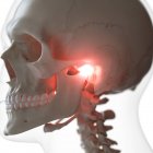 Digital illustration of painful temporomandibular joint in human skeleton. — Stock Photo